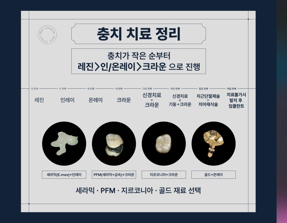 충치치료방법 레진, 인레이/온레이, 크라운 차이 (충치치료비용) 관련 이미지 6