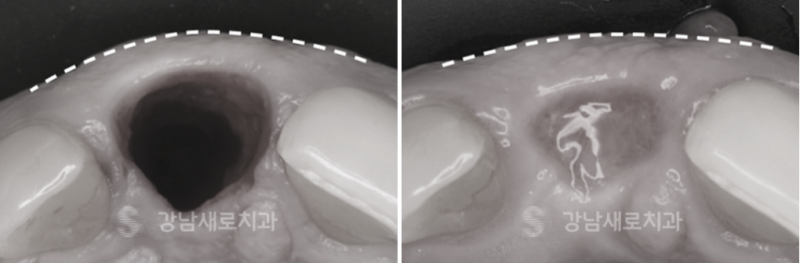 강남양심치과에서 문제 없이 진료를 진행하려면 관련 이미지 10