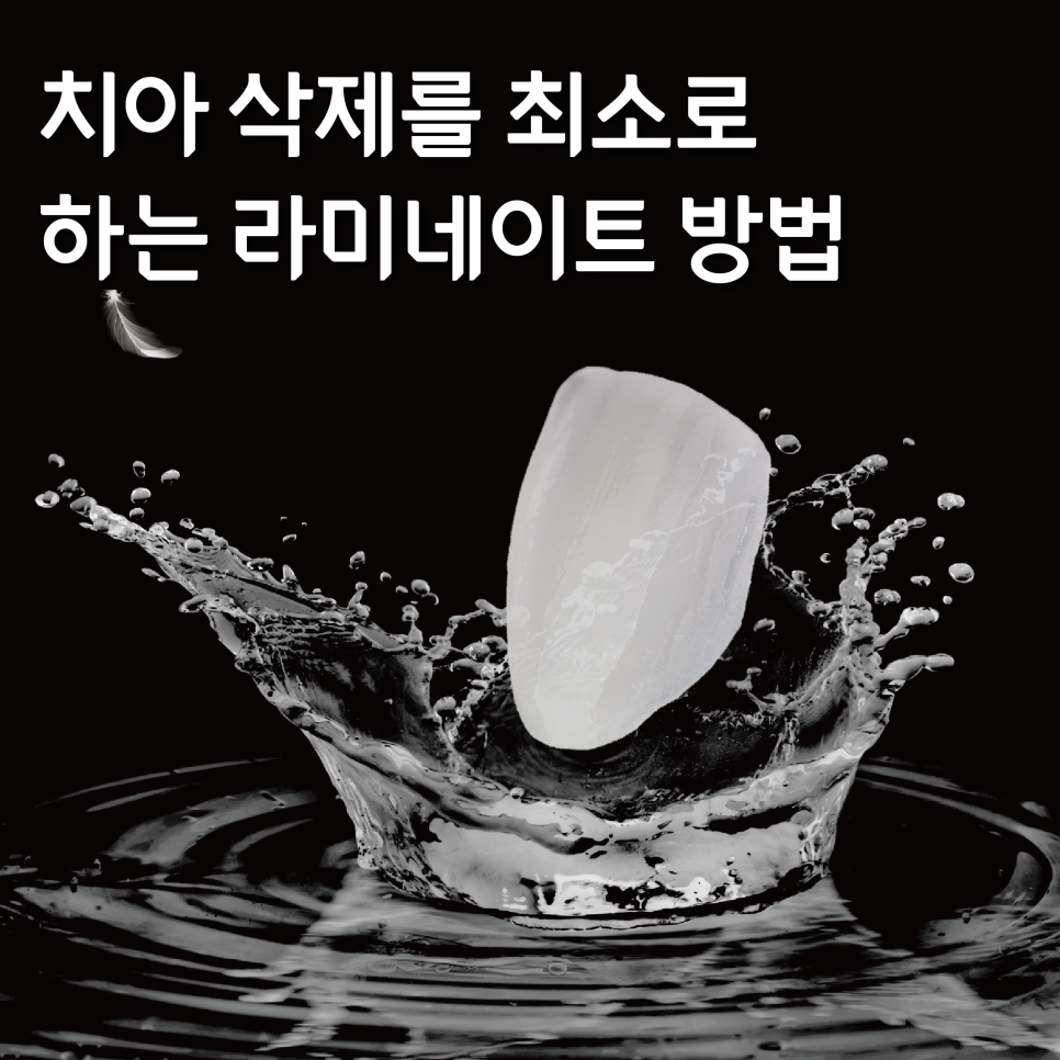 헨리라미네이트? 치아 삭제를 최소로 하는 방법 관련 이미지 1