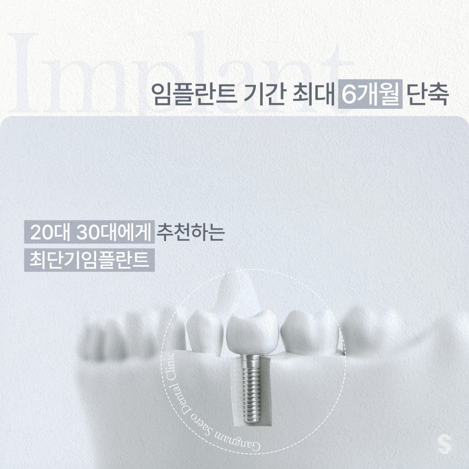 임플란트기간 최대 6개월 단축 20대 30대에게 추천하는 (최단기임플란트) 관련 이미지 1