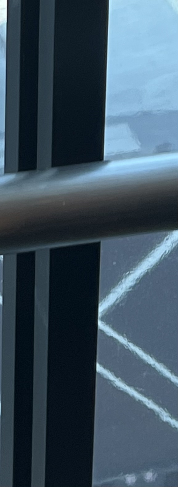 발치 후 교정, 이빨을 뽑지 않는 치료 방법이 있다? 관련 이미지 12