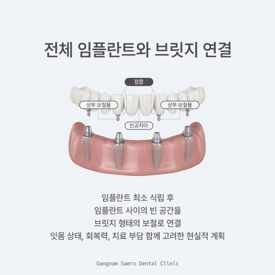 부모님 선물 임플란트 생각하고 있다면 (전체임플란트) 관련 이미지 4
