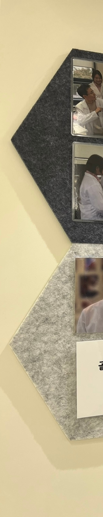 뻐드렁니교정치료, 돌출입을 단기간에 개선하는 방법? 관련 이미지 11