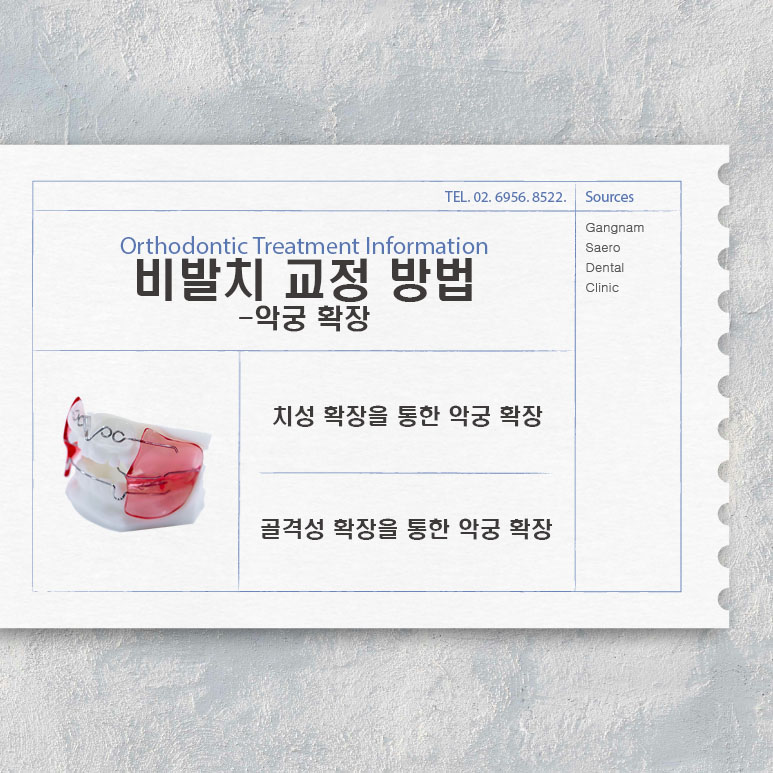 교정 전 발치 필수인가요? (비발치 중심 치아 교정) 관련 이미지 4