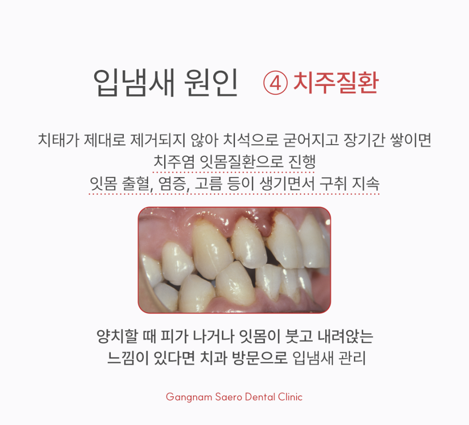 Bad Breath Clinic: What If You Have Bad Breath Even Though You Brush Regularly? image 6