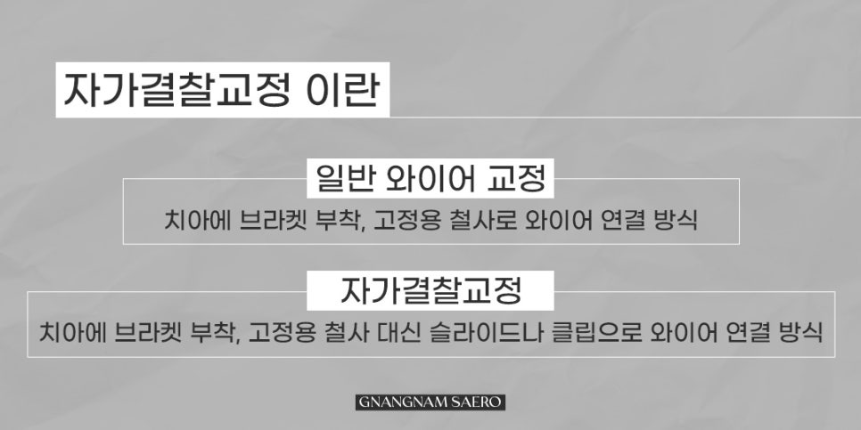 클리피씨가 뭔가요? 데이몬 클리어는 뭔가요? (자가결찰교정종류) 관련 이미지 2