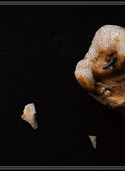 탕후루 충치, 치아 건강에 치명적? 관련 이미지 2