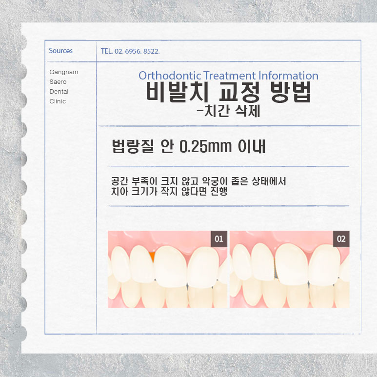 교정 전 발치 필수인가요? (비발치 중심 치아 교정) 관련 이미지 5
