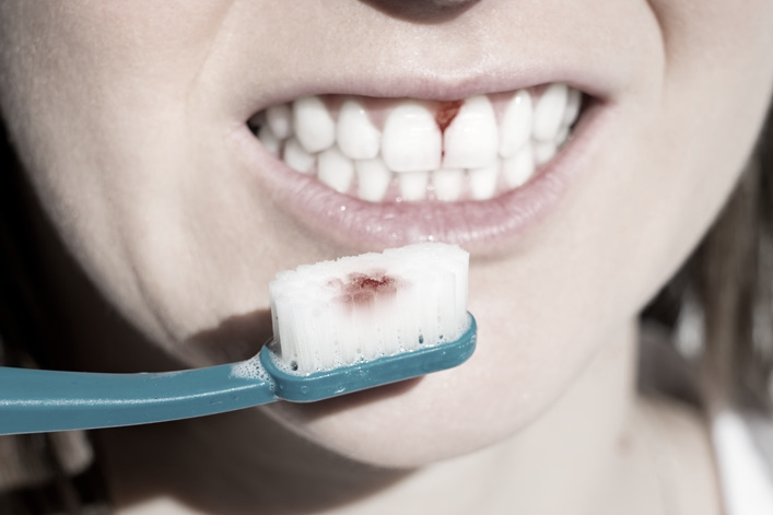 강남양심치과에서 문제 없이 진료를 진행하려면 관련 이미지 3