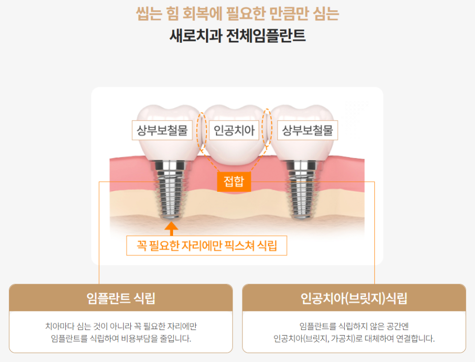 전체임플란트 부작용 최소화하려면 (성공률 높은 임플란트) 관련 이미지 6
