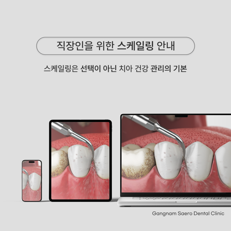 Scaling Guide for Office Workers (Scaling Time, Scaling Side Effects, Scaling Cost) image 1
