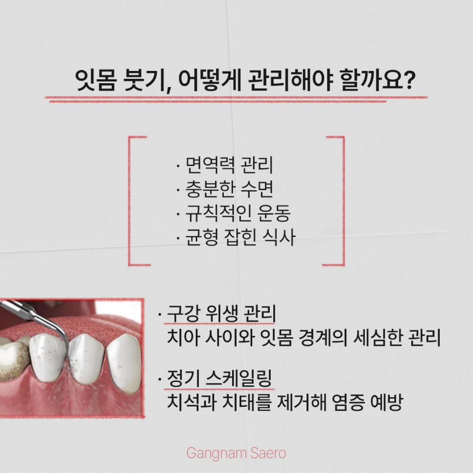 (잇몸부었을때) 그냥 두지 마세요! 체크해 봐야 할 사항들! 관련 이미지 5