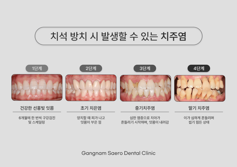 Scaling Guide for Office Workers (Scaling Time, Scaling Side Effects, Scaling Cost) image 3
