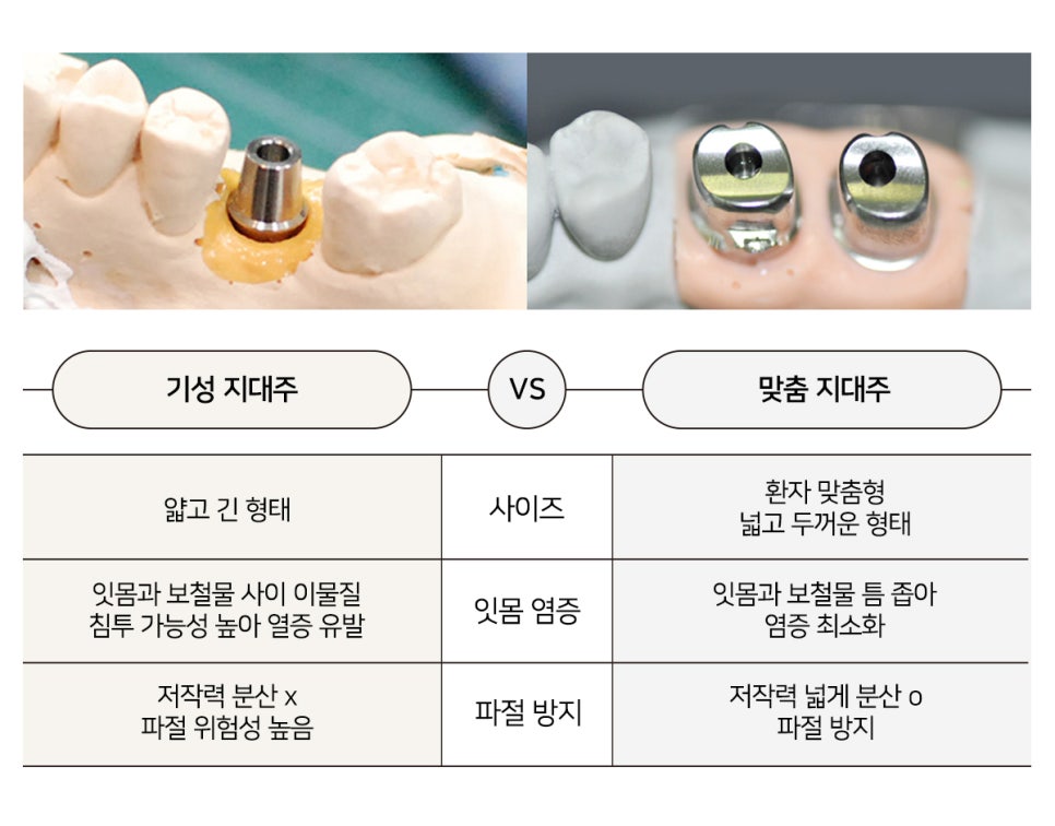임플란트 성공률 수술 전 살펴봐야할 것 (임플란트주의사항) 관련 이미지 11