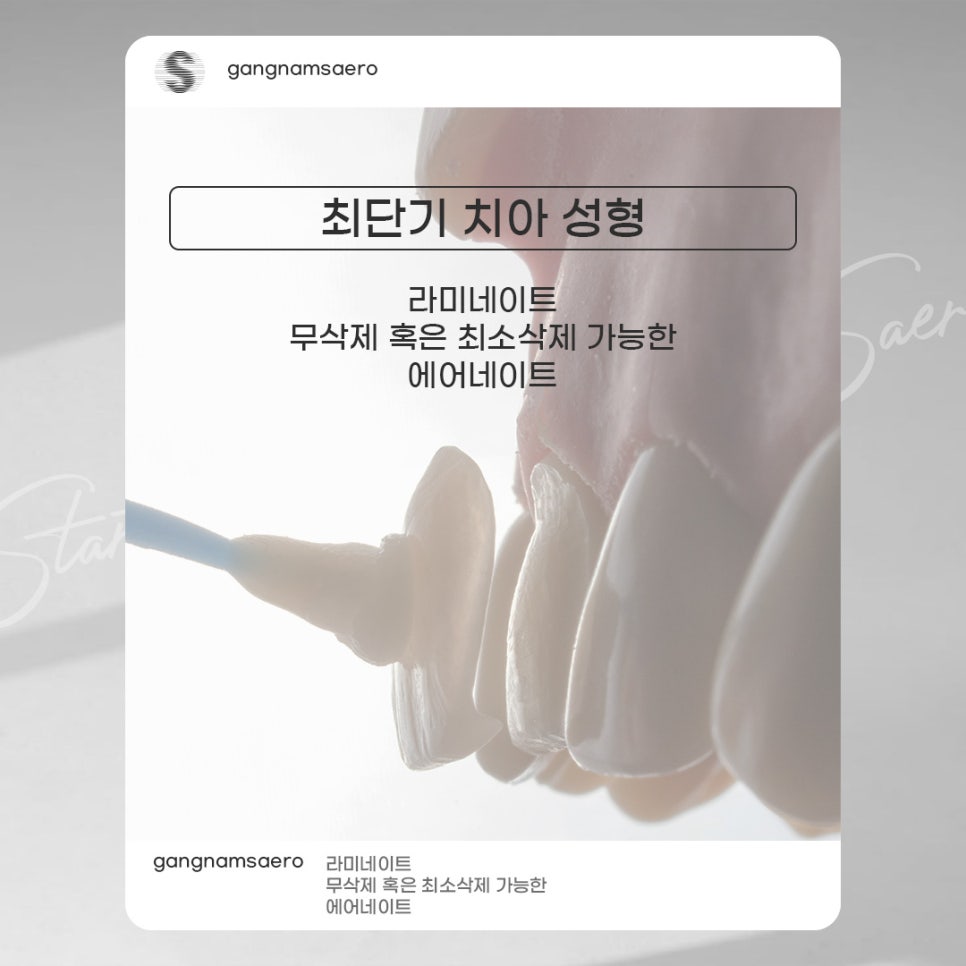 무삭제라미네이트 로 완성하는 가장 빠른 치아성형 (7DAYS치아성형) 관련 이미지 2