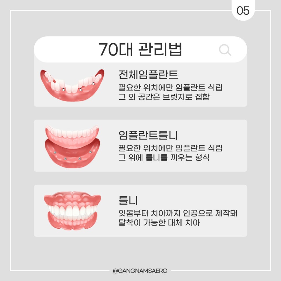 연령대별 치아 관리, 대체 치아 치료법 모음 (임플란트틀니) 관련 이미지 5