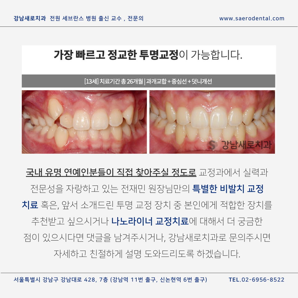 투명치아교정, 모든 종류를 보유한  강남새로치과 관련 이미지 14