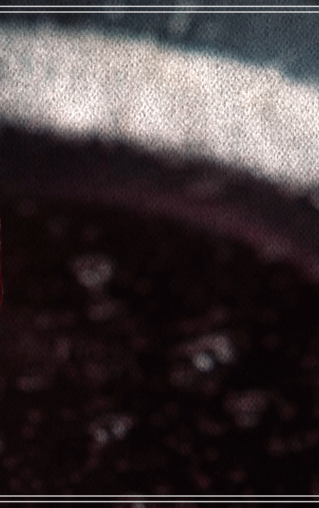 탕후루 충치, 치아 건강에 치명적? 관련 이미지 7