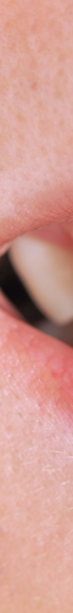 부정교합 교정치료, 비발치로 진행하려면? 관련 이미지 2