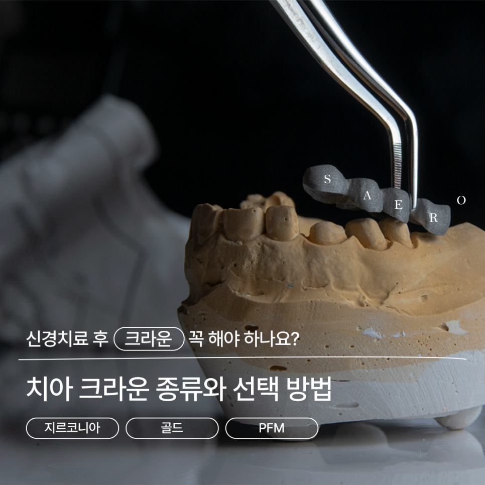 치아크라운, 신경치료 후 꼭 해야 하나요? 종류와 선택 방법까지 관련 이미지 1