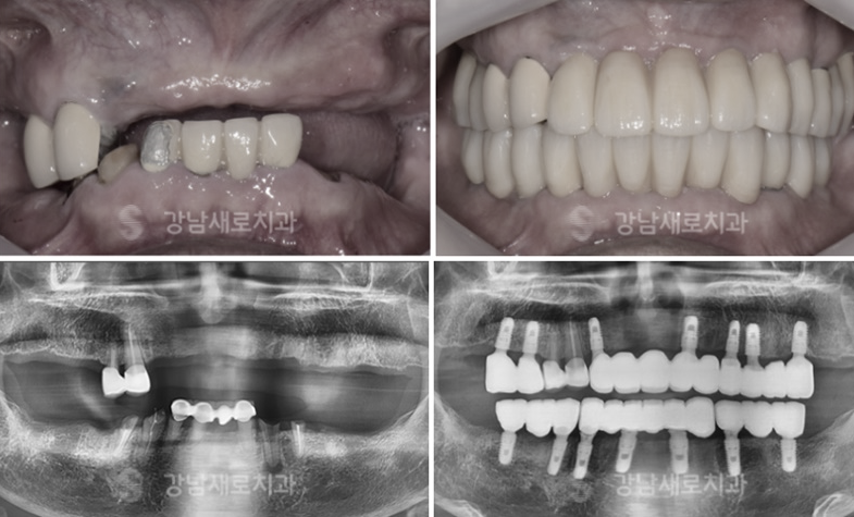 강남양심치과에서 문제 없이 진료를 진행하려면 관련 이미지 9