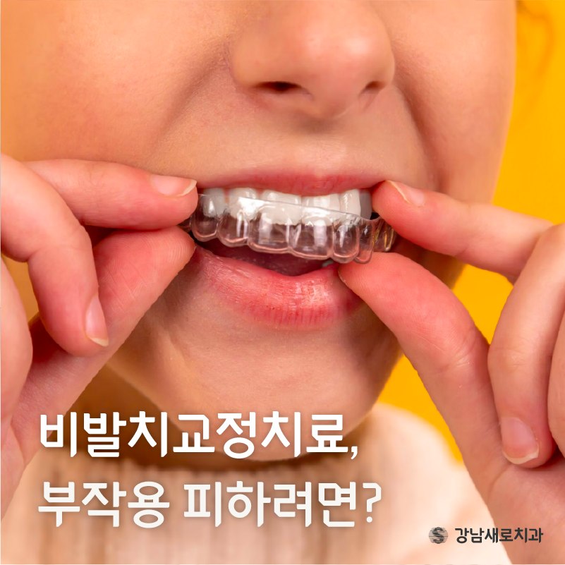 비발치교정치료, 부작용 피하는 방법? 관련 이미지 4