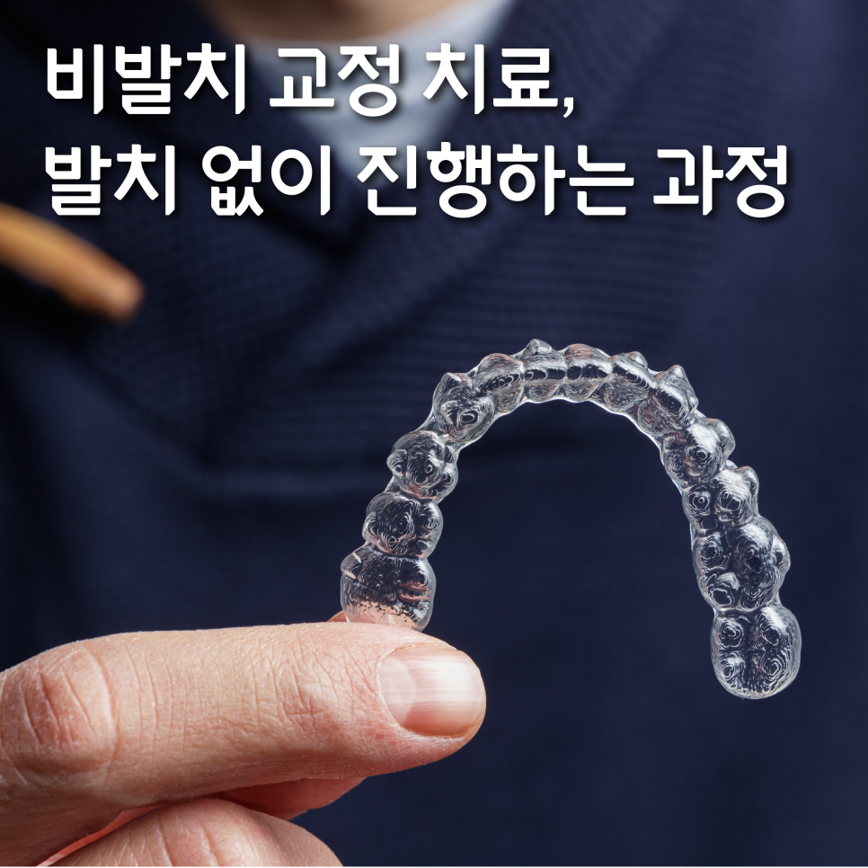 비발치교정 치료, 발치 없이 진행하는 과정 관련 이미지 1