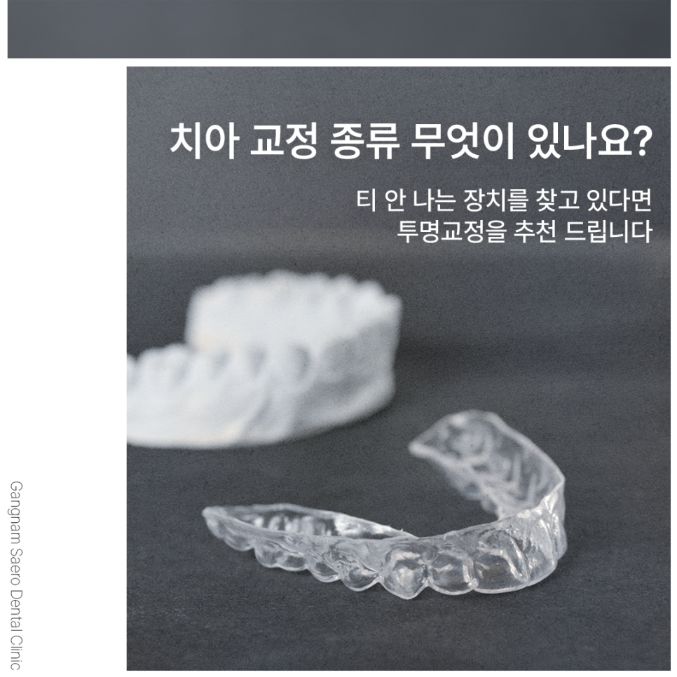 치아교정종류 한눈에 보기 티 안나게 예뻐지고 싶다면 (투명교정) 관련 이미지 5