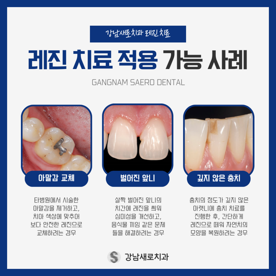 치아파손치료가 필요한 대상과 증상 및 진료 과정 관련 이미지 3