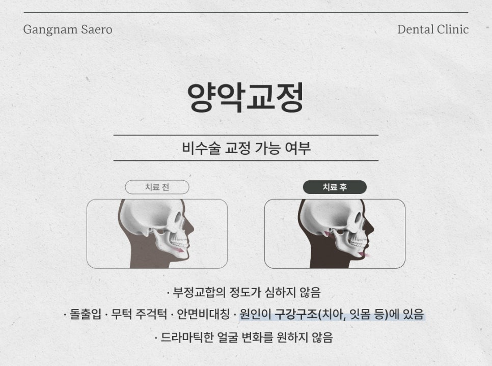 치아교정 으로 해결하는 외모 콤플렉스 (부정교합교정 앞니교정 잇몸교정) 관련 이미지 3
