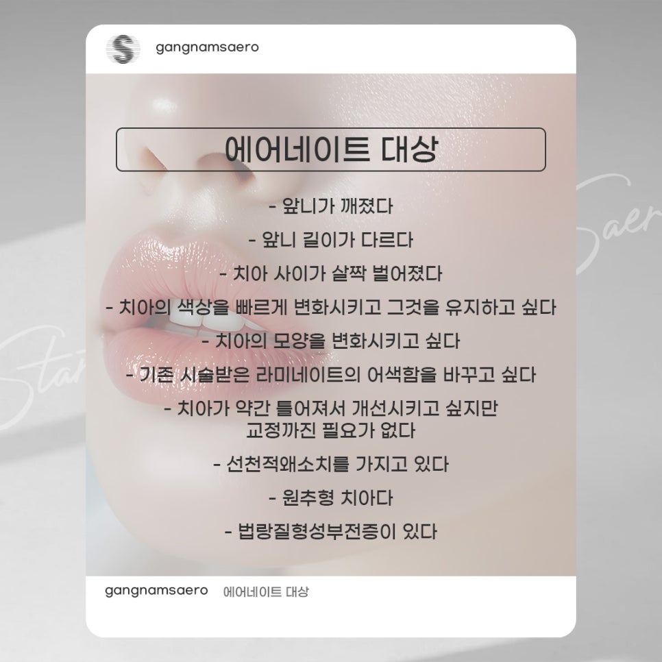 무삭제라미네이트 로 완성하는 가장 빠른 치아성형 (7DAYS치아성형) 관련 이미지 4