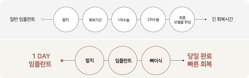 임플란트 추천하는 이유 [ 당일 임플란트 ] [ 강남새로치과 ] 관련 이미지 2