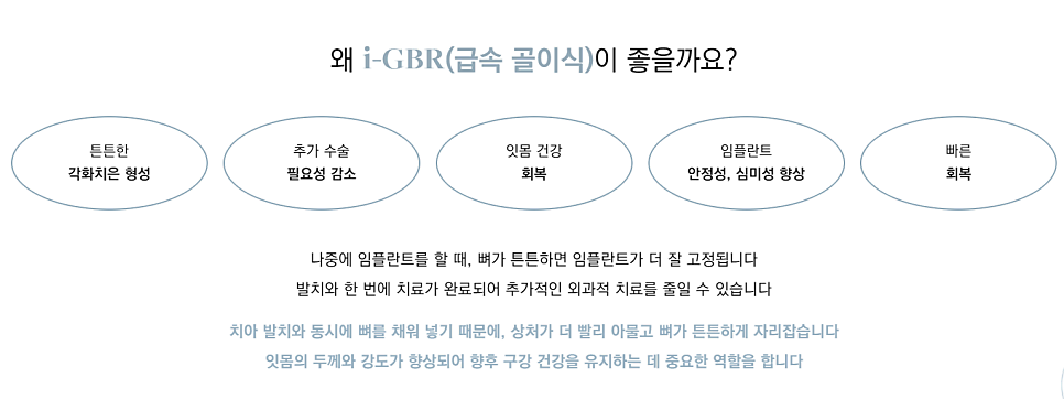 임플란트수술 이란? 부작용 최소화 하려면 반드시 알아야할 것 관련 이미지 8
