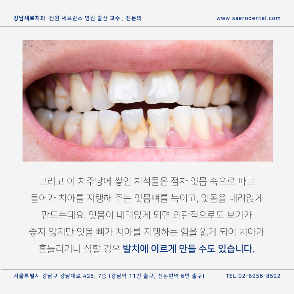 무통스케일링, 관련 이미지 5