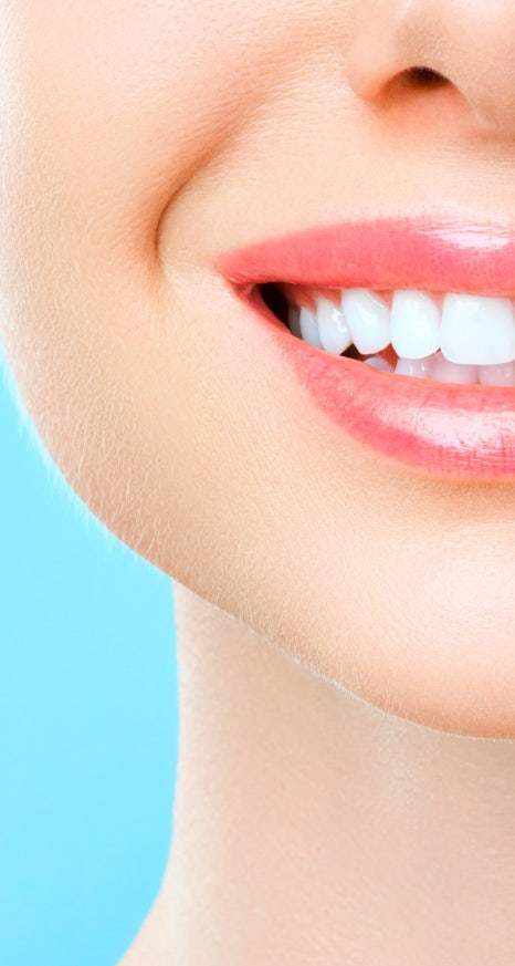 누런 앞니, 치아의 문제를 에어네이트 진료로 해결하려면 관련 이미지 11