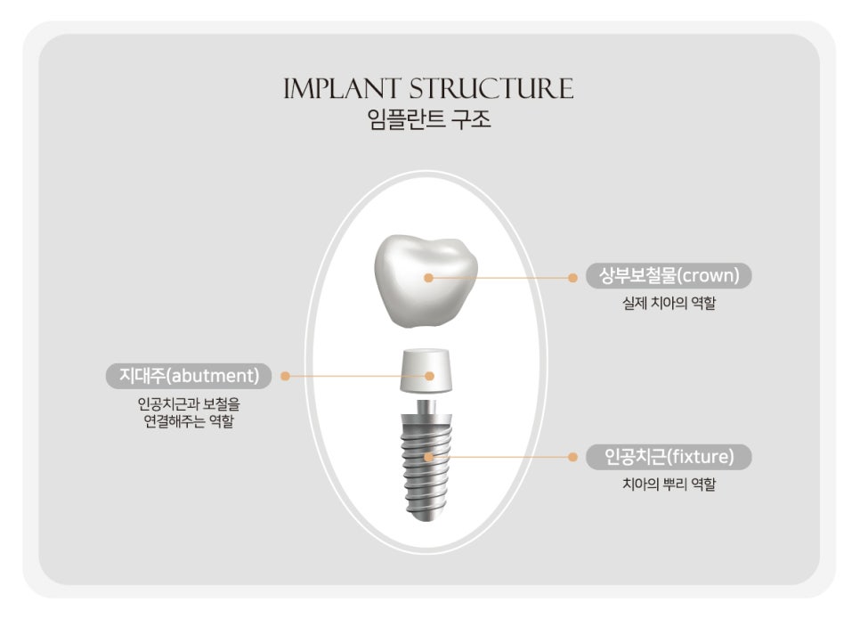 전체를 보면 하나의 결과가 보인다, 강남새로치과 전체임플란트 관련 이미지 1