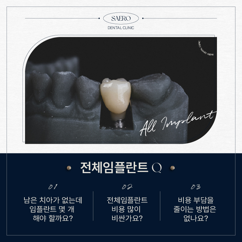 전체임플란트 비용 부담 줄이는 방법 (전체임플란트비용) 관련 이미지 2