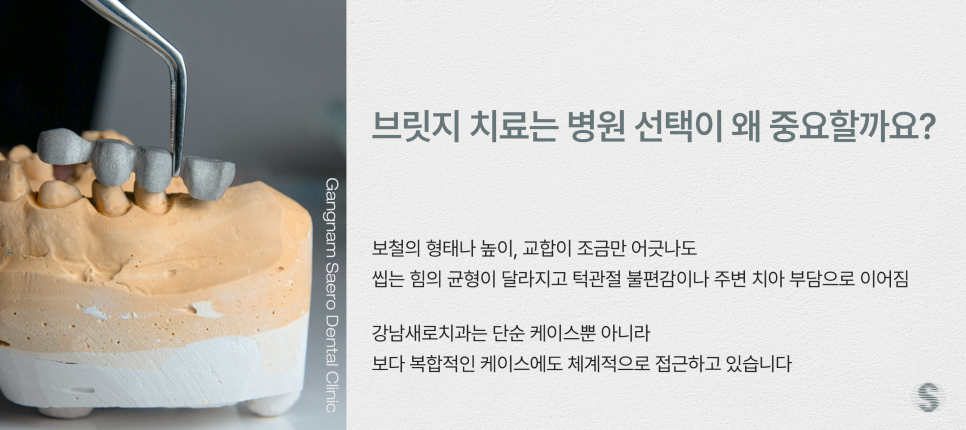 치아를 잃었을 때 치료 방법 (치과 브릿지) 관련 이미지 6