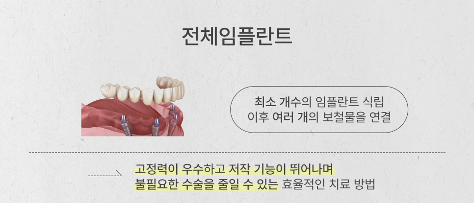 어머니 아버지를 위한 전체임플란트 최소 식립 (65세이상임플란트) 관련 이미지 4
