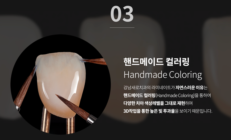 누런 앞니, 치아의 문제를 에어네이트 진료로 해결하려면 관련 이미지 8