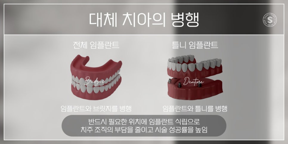 나이가 많은데 임플란트 가능할까요? (65세이상임플란트 건강보험적용) 관련 이미지 5