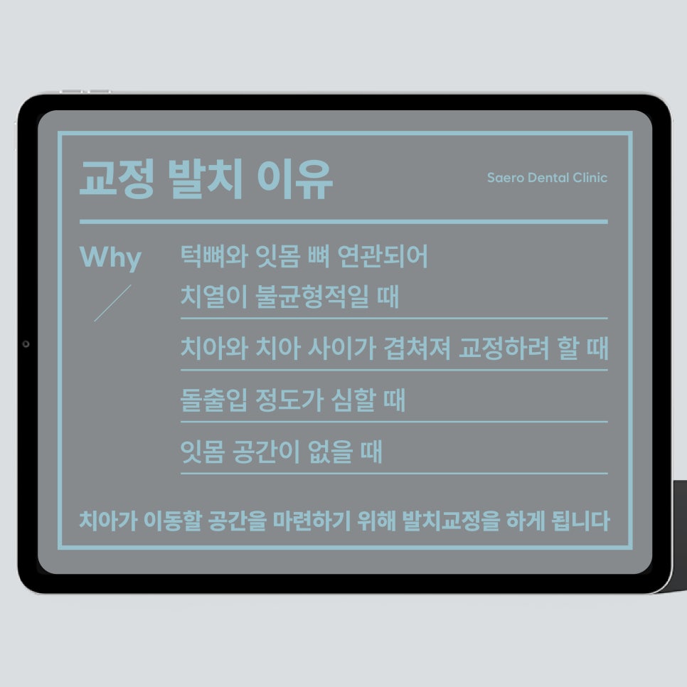 무조건 비발치교정 이 좋은 선택일까요? (발치교정이유 비발치교정이유) 관련 이미지 3