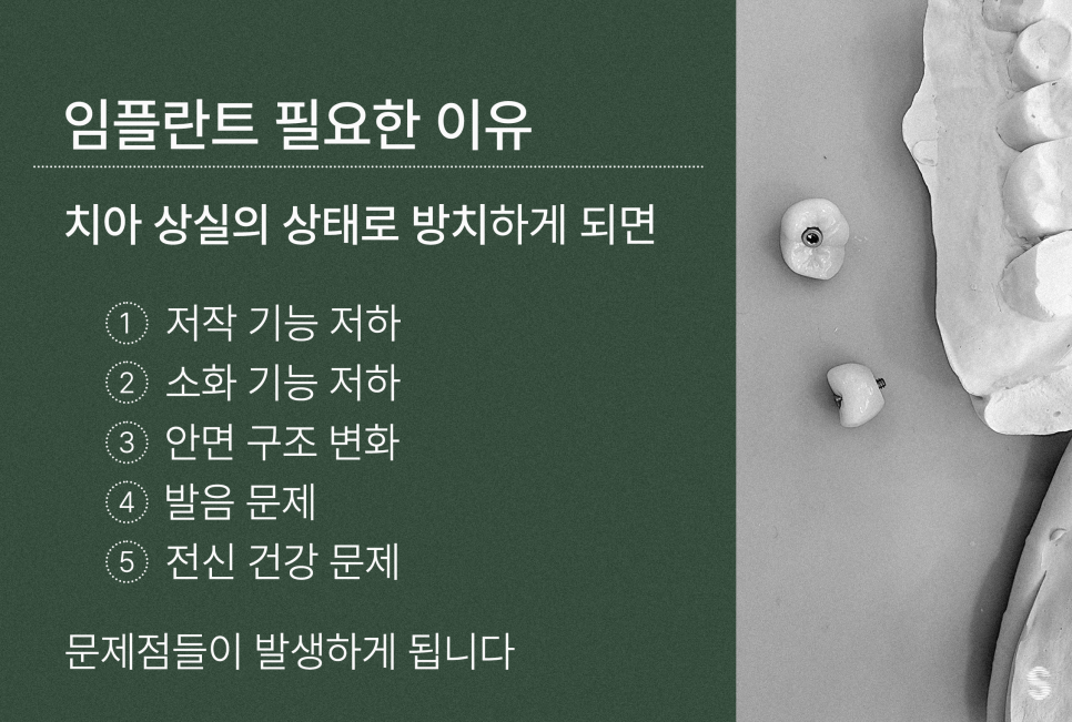 치과 인기 검색어 관련 이미지 2