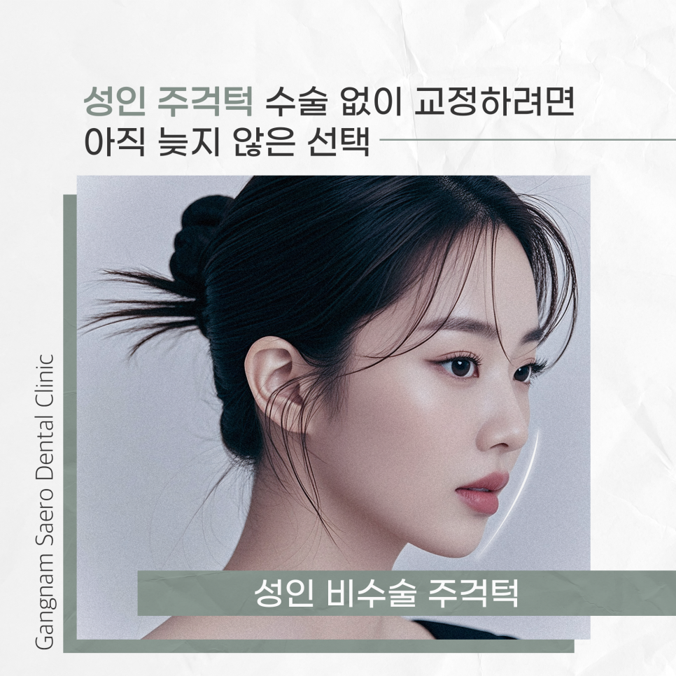 주걱턱 수술 없이 교정하려면 아직 늦지 않은 선택 (성인 비수술주걱턱) 관련 이미지 1