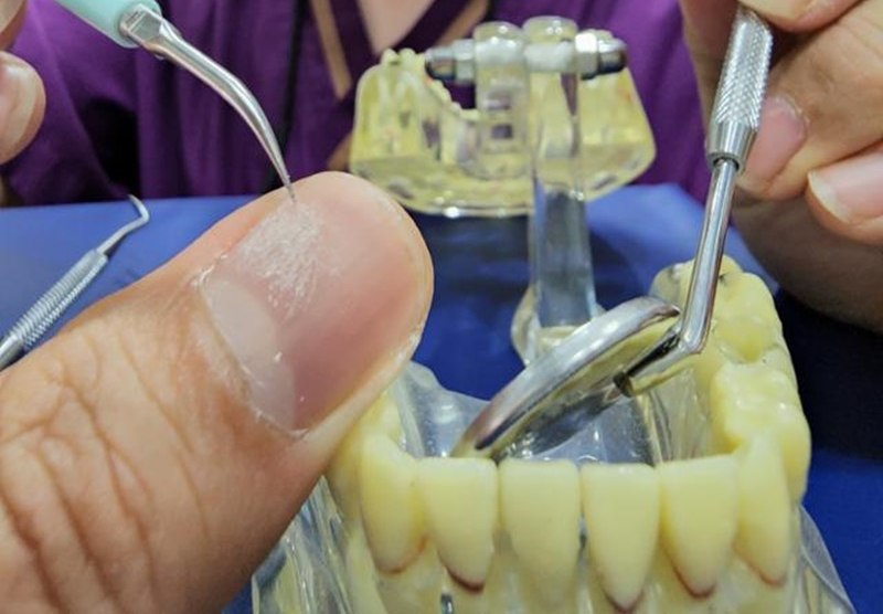 셀프스케일링기구, 치과 전문의들이 반대하는 이유 관련 이미지 11