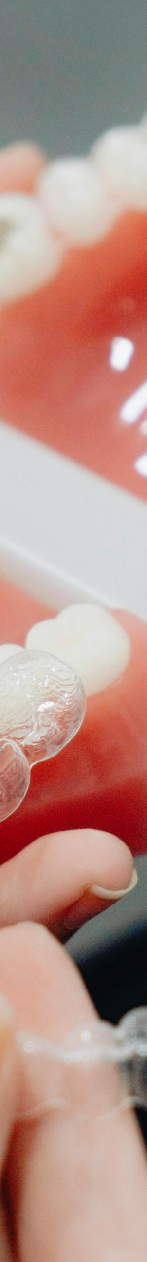 성인치아교정 치료, 부정교합, 구강 건강 개선이 될까요? 고민하고 계시다면 궁금증 타파해드립니다! 관련 이미지 10