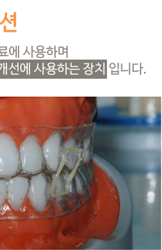 턱통증 치료, 비수술로 해결하는 방법 관련 이미지 6