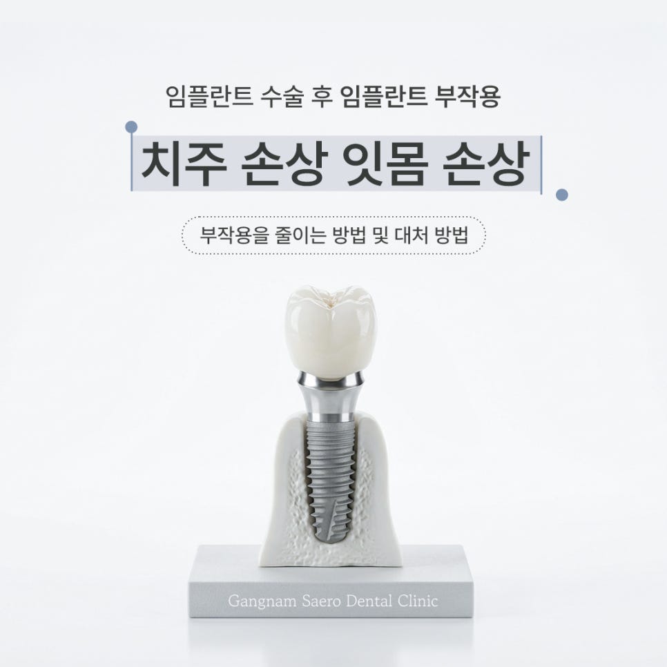 Dental Implant Side Effects: Gums (Periodontal and Gum Tissue Damage) — Prevention and Management image 11