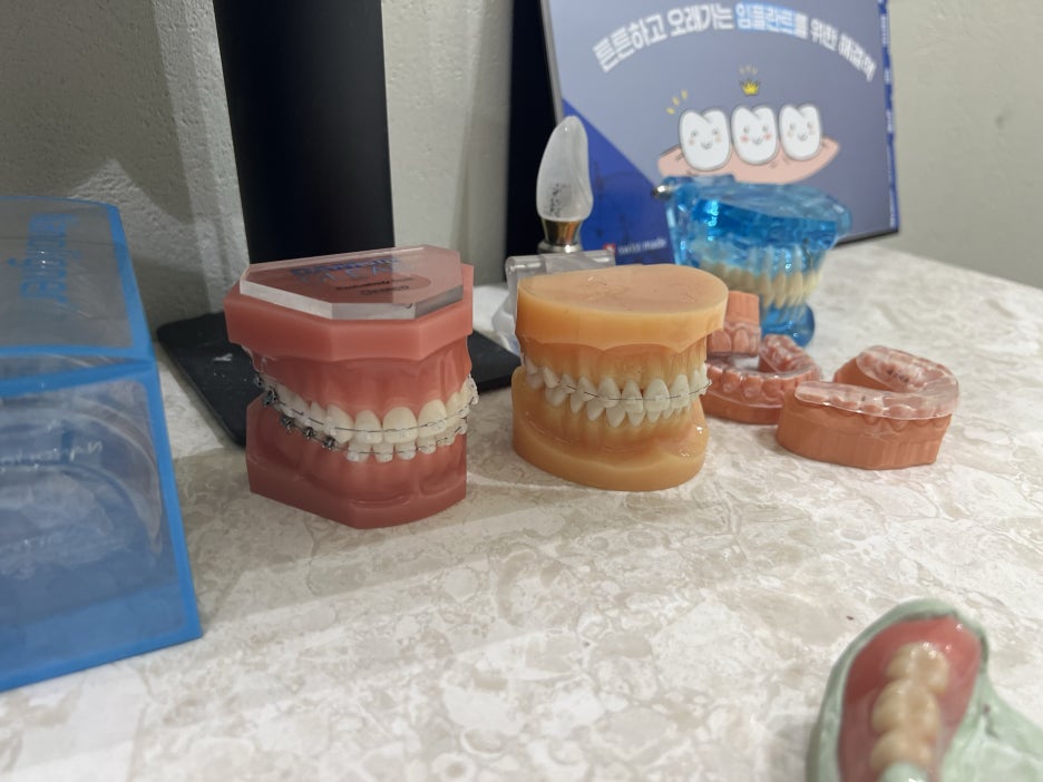 치아 교정을 받고 싶은 분들 주목! 치료 시기와 기간 알려드립니다! 관련 이미지 1