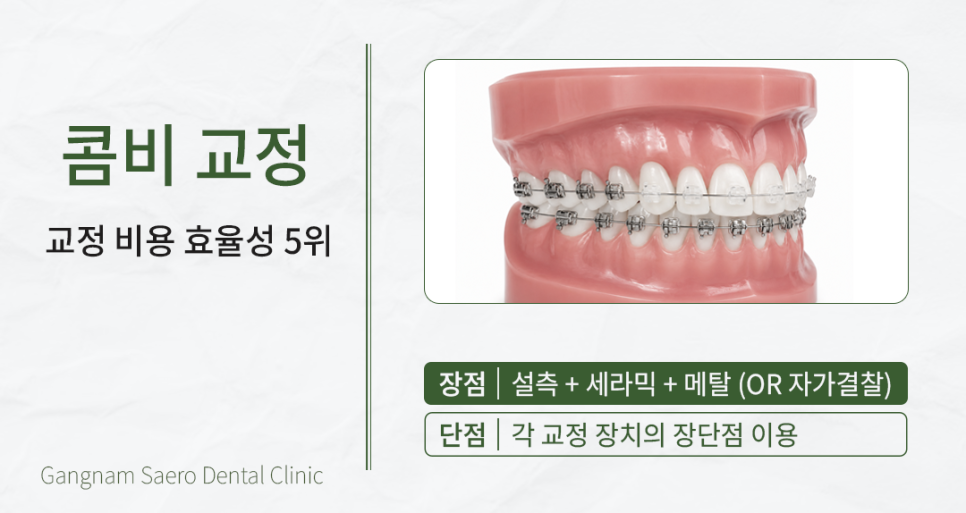 A Time- and Money-Saving Approach to Orthodontic Treatment (Orthodontic Treatment Cost) image 7